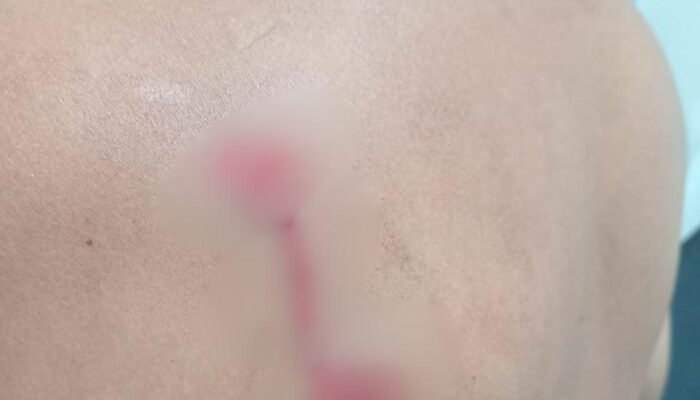 Ditikam Dua Kali, Nelayan di Gorontalo Justru Jadi Tersangka